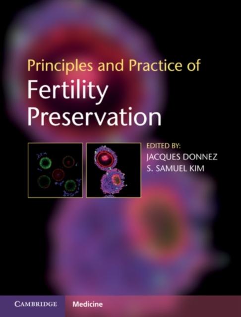 Principles and Practice of Fertility Preservation als eBook Download von