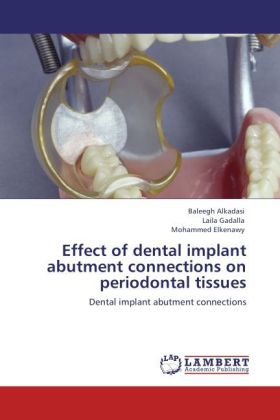Effect of dental implant abutment connections on periodontal tissues als Buch von Baleegh Alkadasi, Laila Gadalla, Mohammed Elkenawy - Baleegh Alkadasi, Laila Gadalla, Mohammed Elkenawy