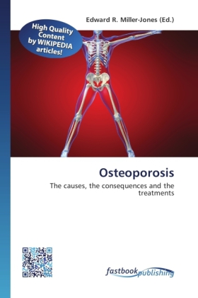 Osteoporosis als Buch von