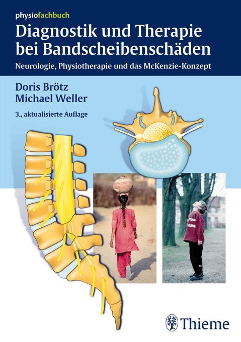 Diagnostik und Therapie bei Bandscheibenschäden als eBook Download von Doris Brötz, Michael Weller - Doris Brötz, Michael Weller
