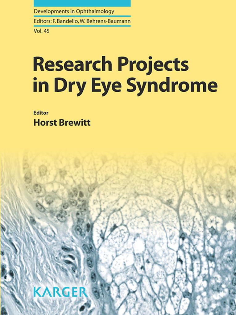 Research Projects in Dry Eye Syndrome als eBook Download von