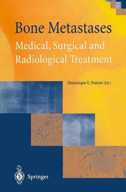 Bone Metastases als eBook Download von