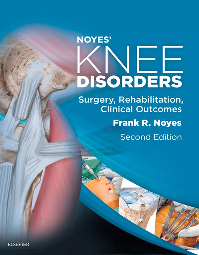 Noyes´ Knee Disorders: Surgery, Rehabilitation, Clinical Outcomes E-Book als eBook Download von Frank R. Noyes - Frank R. Noyes