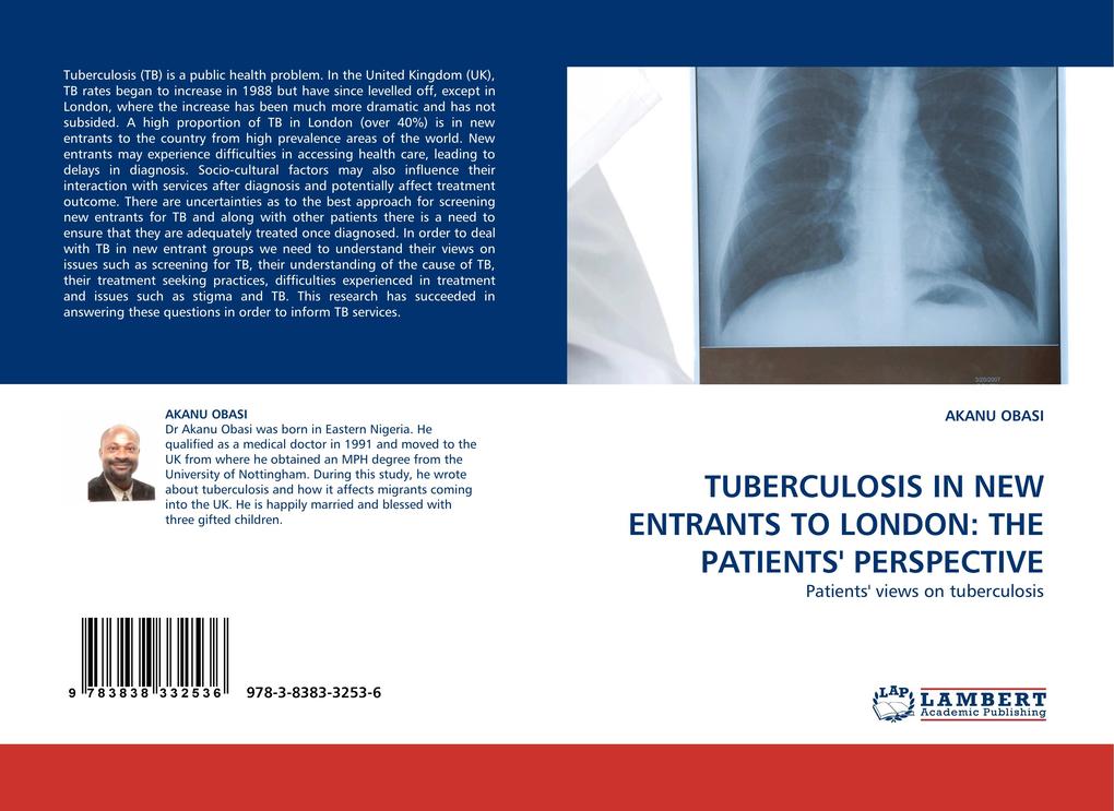 TUBERCULOSIS IN NEW ENTRANTS TO LONDON: THE PATIENTS'' PERSPECTIVE - AKANU OBASI