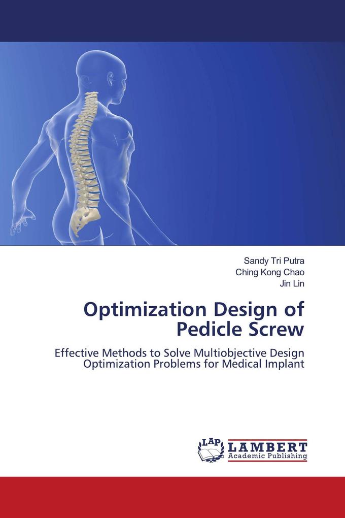 Optimization Design of Pedicle Screw