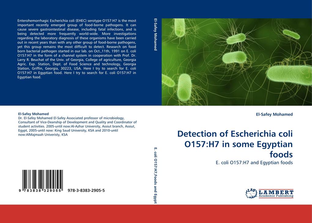 Detection of Escherichia coli O157:H7 in some Egyptian foods