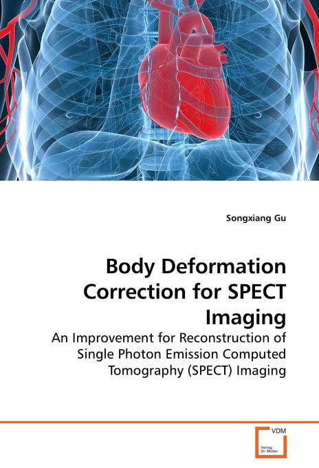 Body Deformation Correction for SPECT Imaging