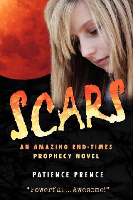SCARS