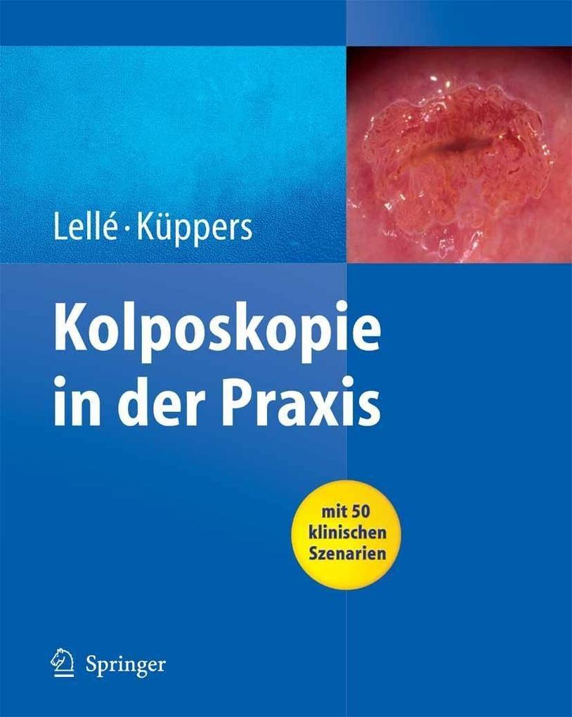 Kolposkopie in der Praxis