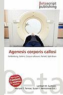 Agenesis corporis callosi