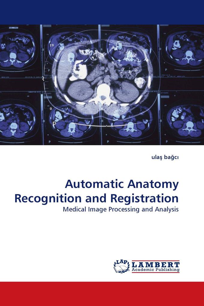 Automatic Anatomy Recognition and Registration