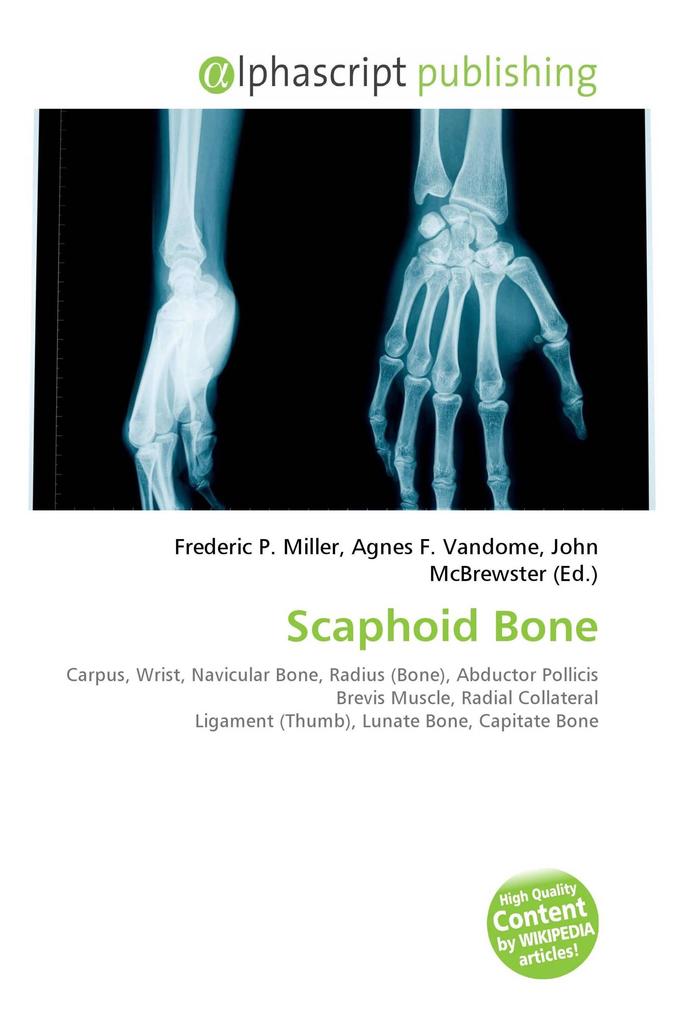 Scaphoid Bone
