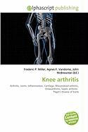 Knee arthritis