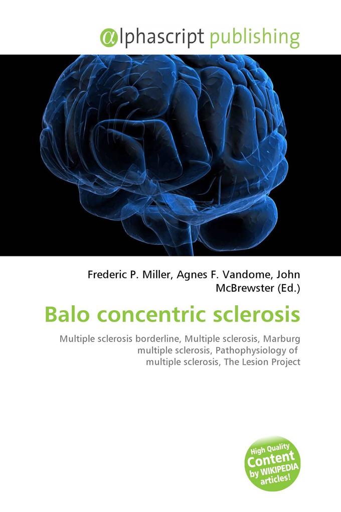 Balo concentric sclerosis