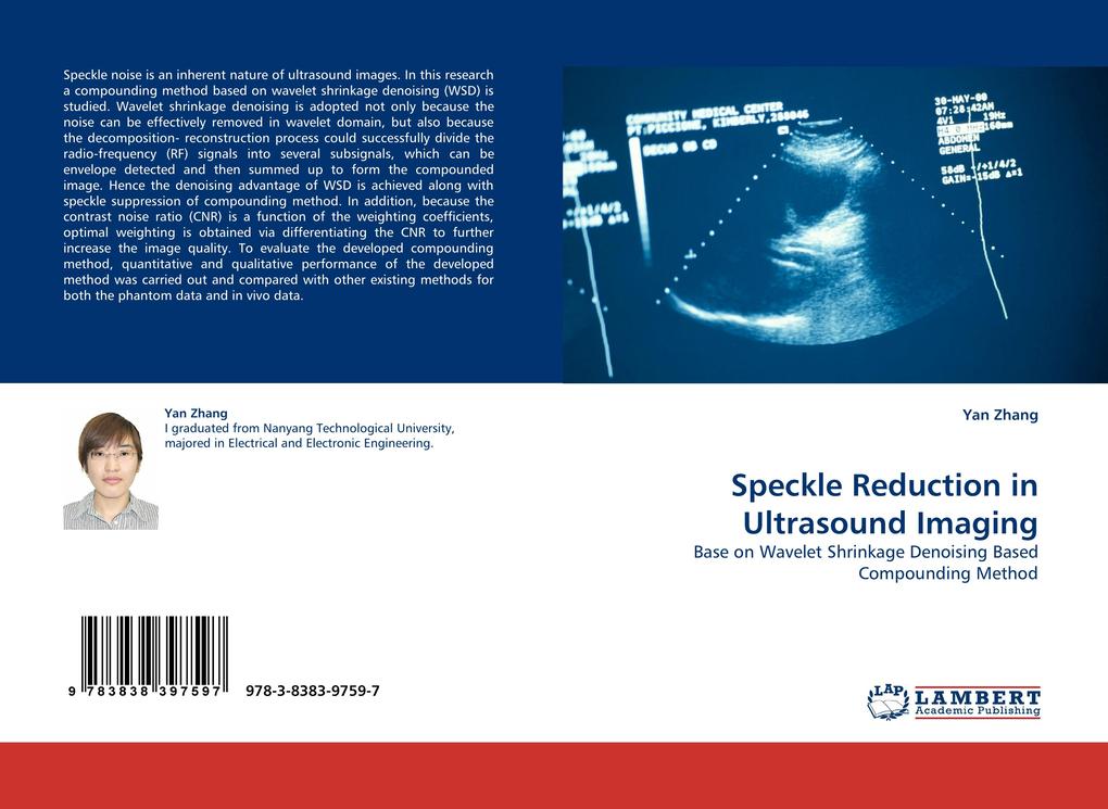 Speckle Reduction in Ultrasound Imaging