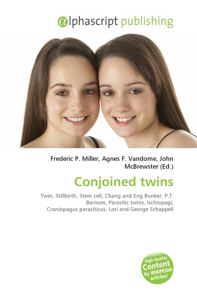 Conjoined twins
