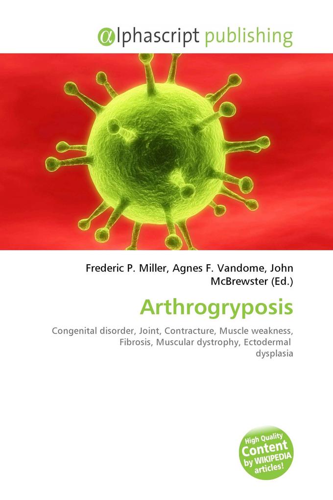 Arthrogryposis