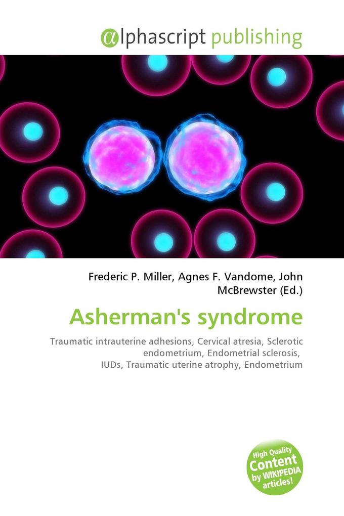 Asherman's syndrome