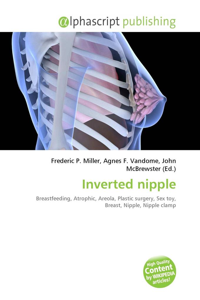Inverted nipple