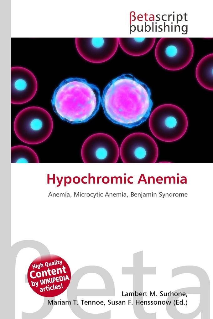 Hypochromic Anemia