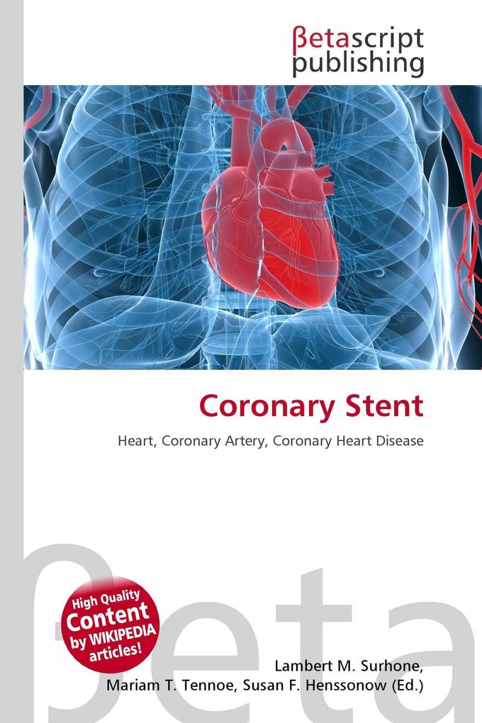 Coronary Stent