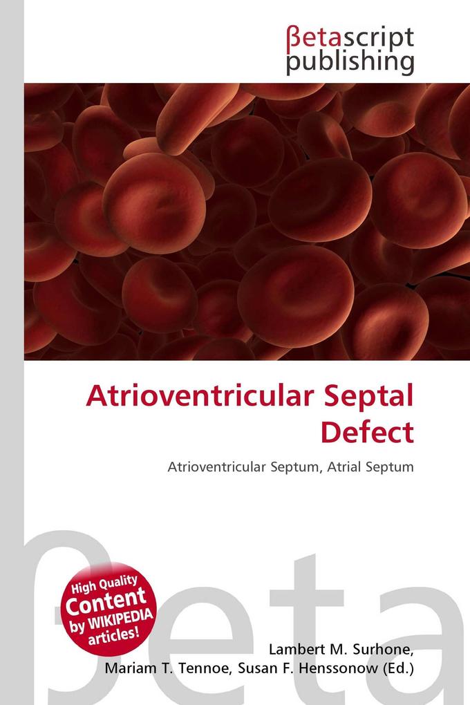 Atrioventricular Septal Defect