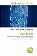Liver tumor