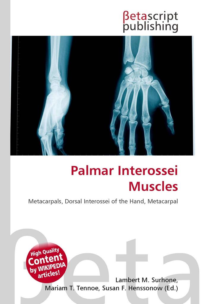 Palmar Interossei Muscles