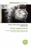 Knee replacement