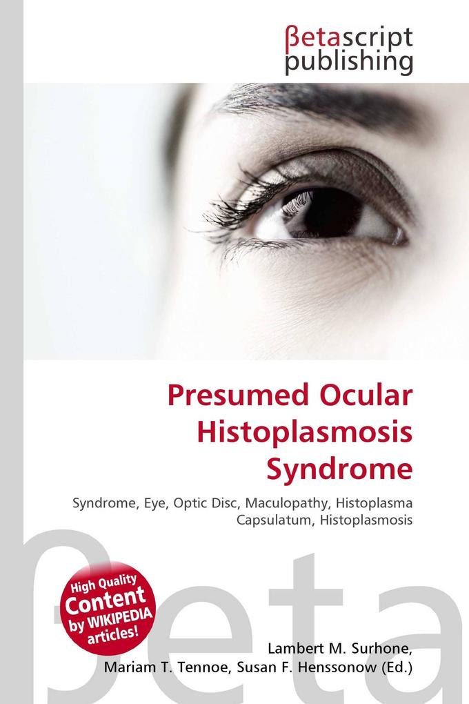 Presumed Ocular Histoplasmosis Syndrome
