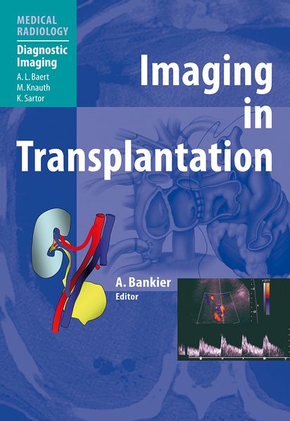 Imaging in Transplantation