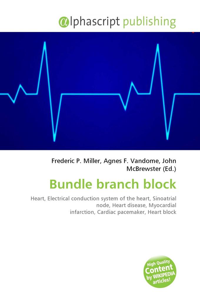 Bundle branch block