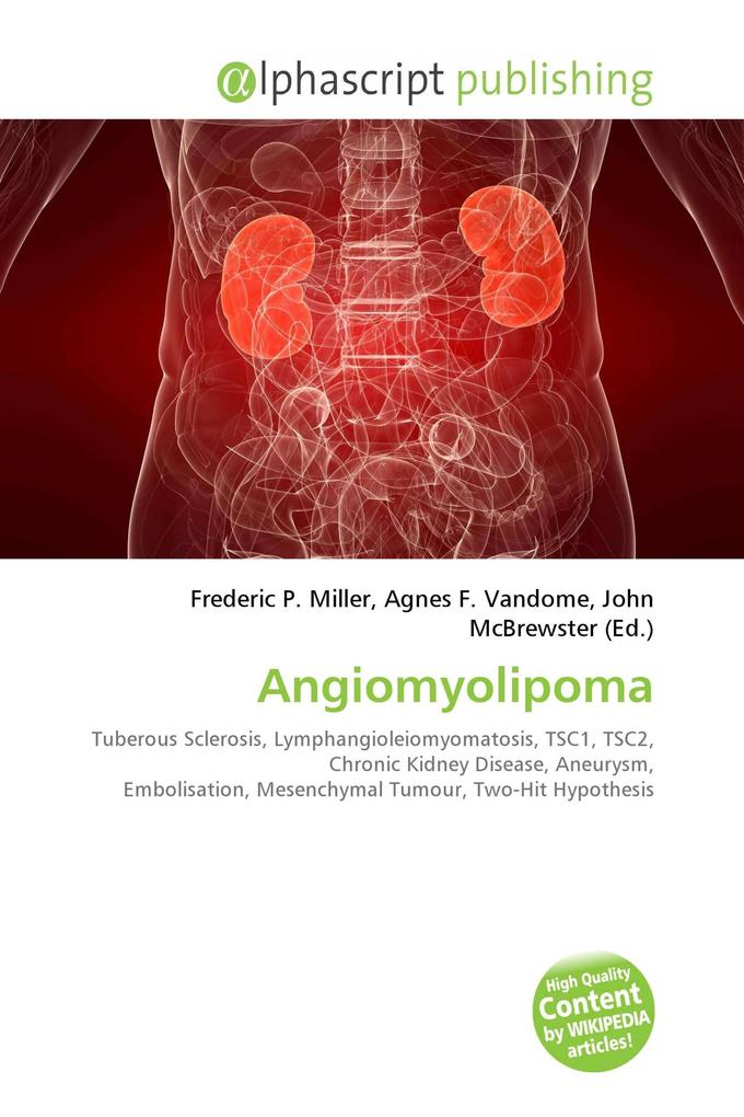 Angiomyolipoma