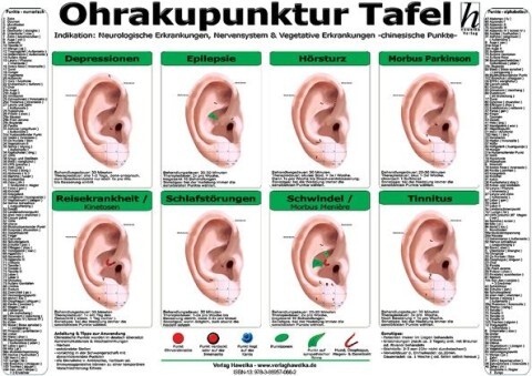 Ohrakupunktur Tafel - Indikation: Neurologische Erkrankungen Nervensystem & Vegetative Erkrankungen