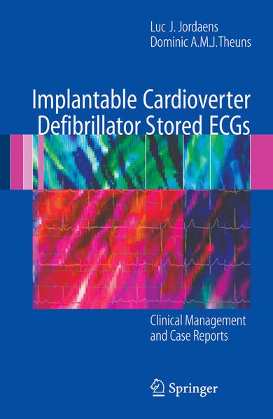 Implantable Cardioverter Defibrillator Stored ECGs