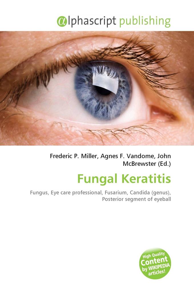 Fungal Keratitis