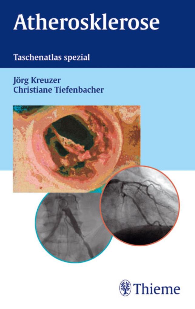 Atherosklerose - Jörg Kreuzer/ Christiane Tiefenbacher