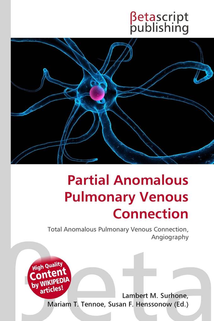Partial Anomalous Pulmonary Venous Connection