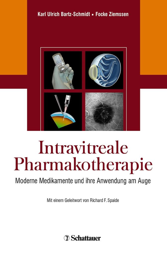 Intravitreale Pharmakotherapie - Karl Ulrich Bartz-Schmidt