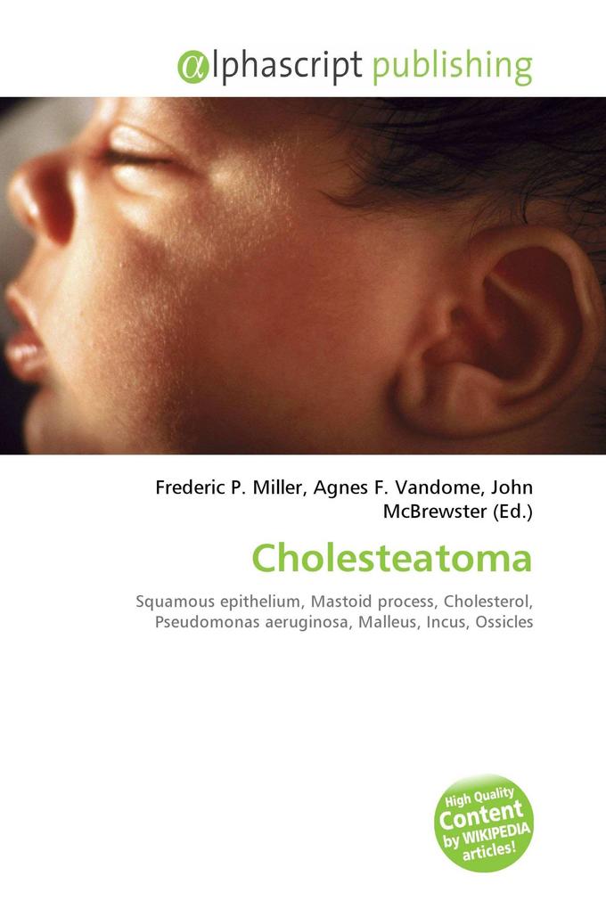 Cholesteatoma
