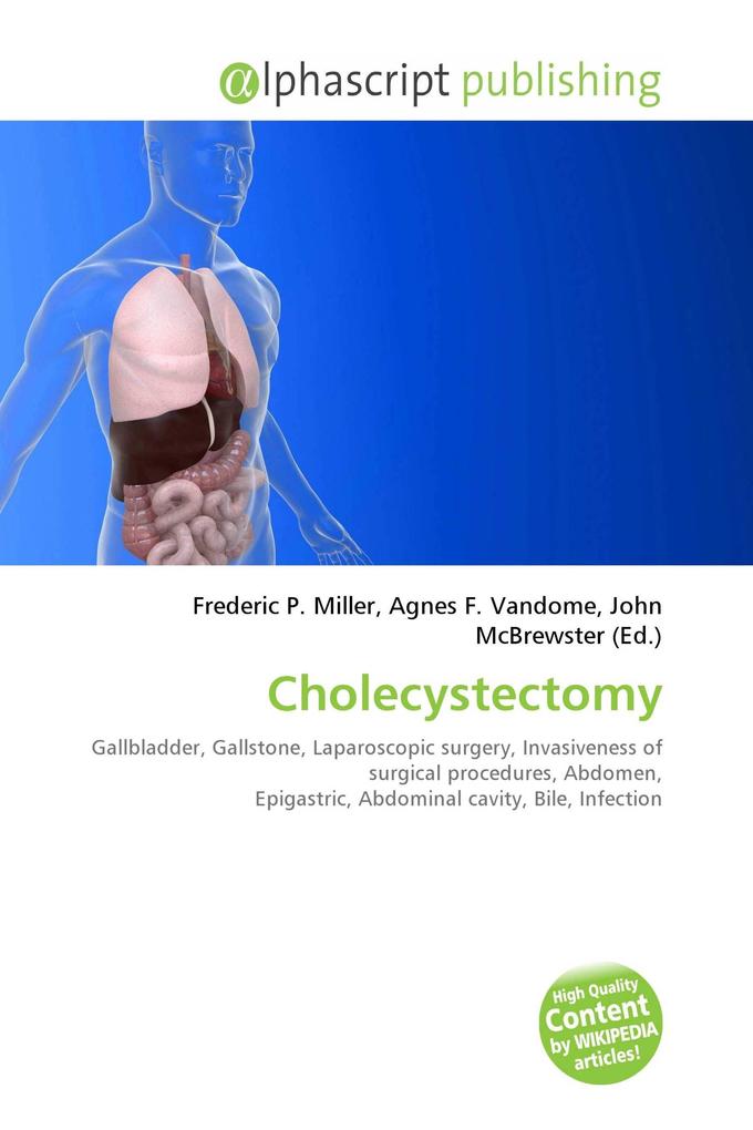 Cholecystectomy