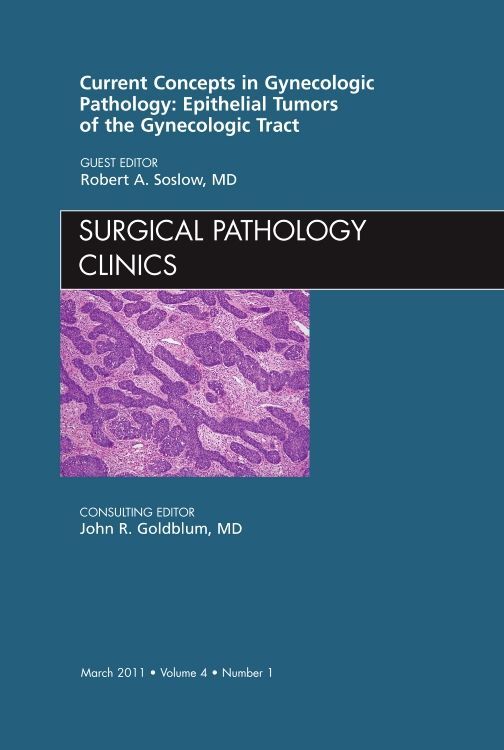 Current Concepts in Gynecologic Pathology: Epithelial Tumors of the Gynecologic Tract An Issue of S