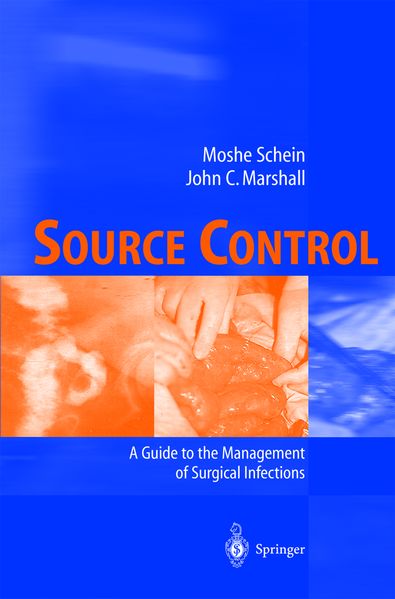 Source Control