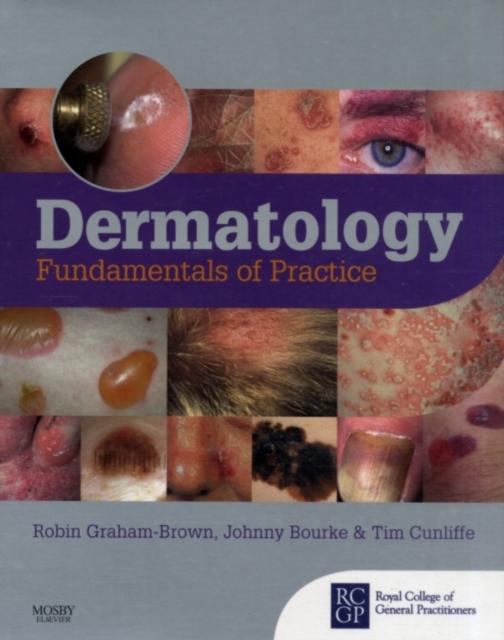 Dermatology