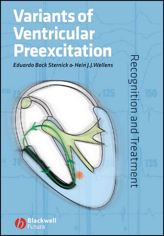 Variants of Ventricular Preexcitation