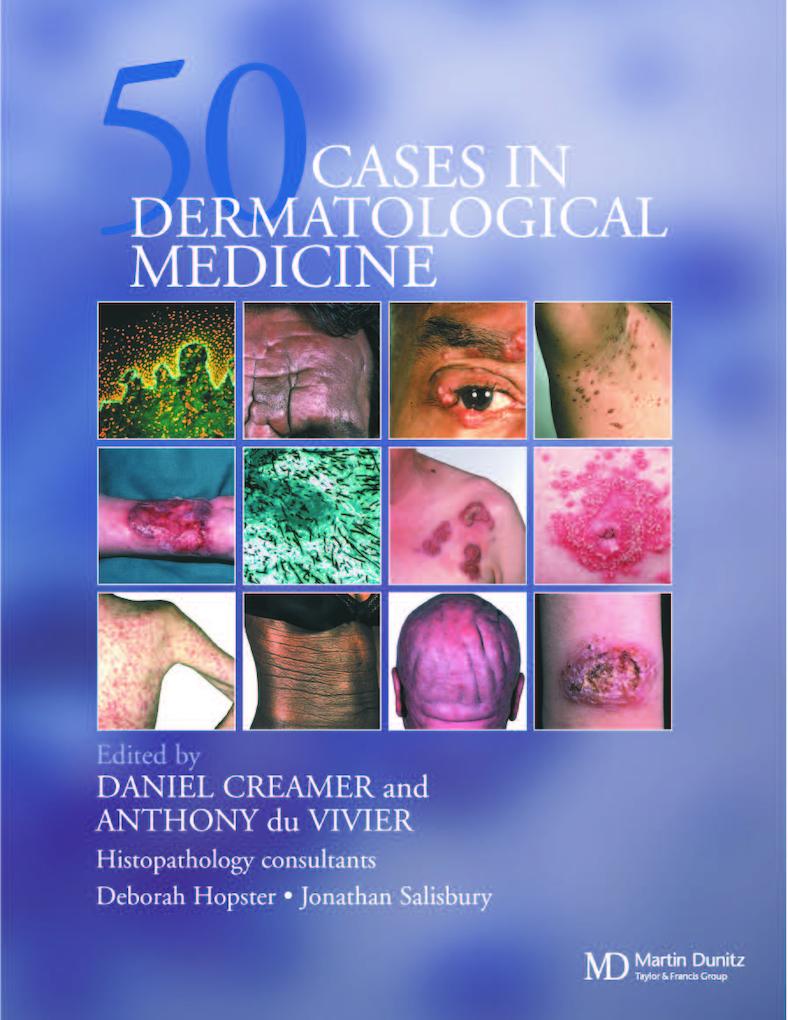 Fifty Dermatological Cases