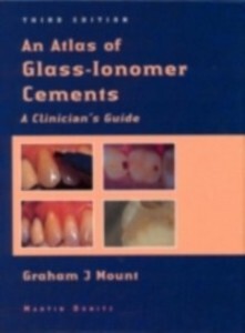 Atlas of Glass-Ionomer Cements als eBook Download von Graham J. Mount - Graham J. Mount