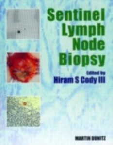 Sentinel Lymph Node Biopsy als eBook Download von