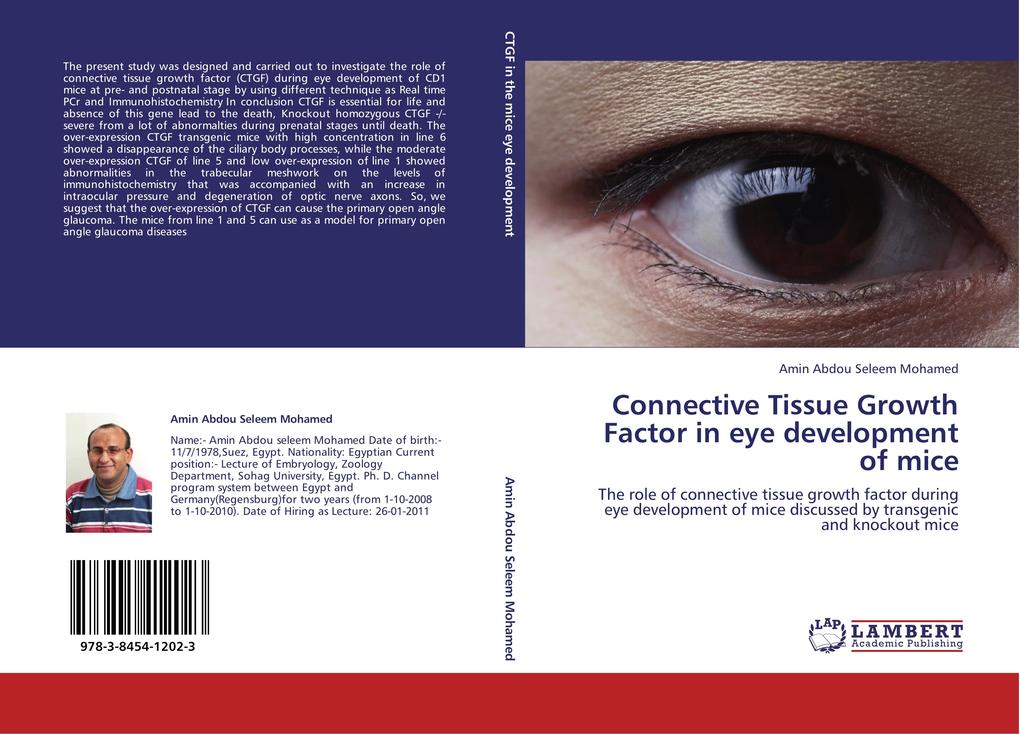 Connective Tissue Growth Factor in eye development of mice