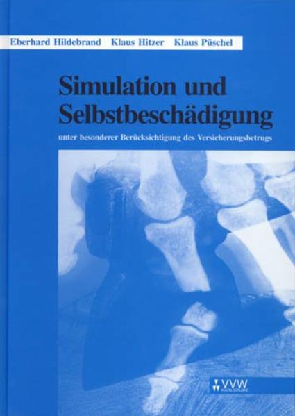Simulation und Selbstbeschädigung - Eberhard Hildebrand/ Klaus Hitzer/ Klaus Püschel